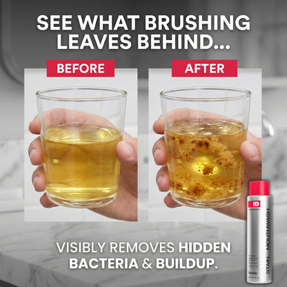 Stain Mouthwash